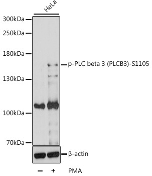 Phospho-PLC beta 3 (PLCB3)-S1105 Rabbit Polyclonal Antibody