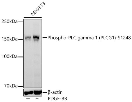 Phospho-PLC gamma 1 (PLCG1)-S1248 Rabbit Monoclonal Antibody