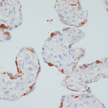 Phospho-PLC gamma 1 (PLCG1)-S1248 Rabbit Polyclonal Antibody - Image 2