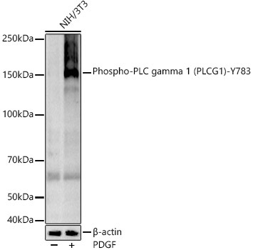 Phospho-PLC gamma 1 (PLCG1)-Y783 Rabbit Monoclonal Antibody