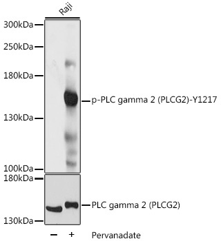 Phospho-PLC gamma 2 (PLCG2)-Y1217 Rabbit Polyclonal Antibody