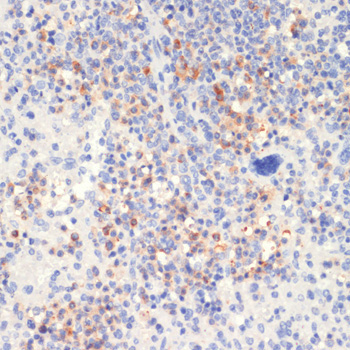 Phospho-PLC gamma 2 (PLCG2)-Y1217 Rabbit Polyclonal Antibody - Image 2