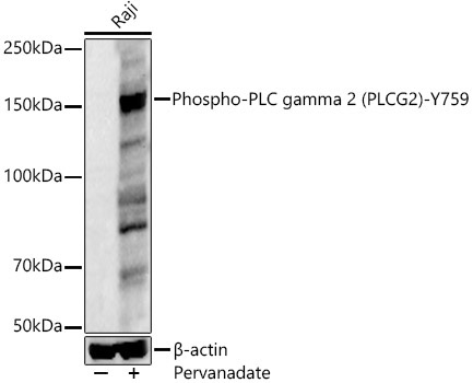 Phospho-PLC gamma 2 (PLCG2)-Y759 Rabbit Polyclonal Antibody