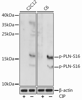 Phospho-PLN-S16 Rabbit Polyclonal Antibody