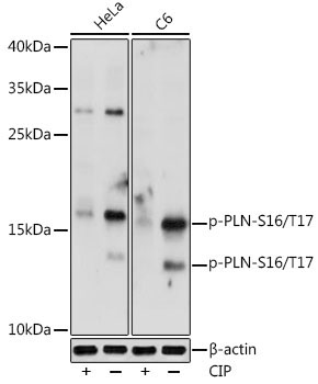 Phospho-PLN-S16/T17 Rabbit Polyclonal Antibody