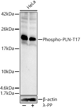 Phospho-PLN-T17 Rabbit Polyclonal Antibody
