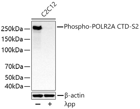 Phospho-POLR2A CTD-S2 Rabbit Monoclonal Antibody - Image 8