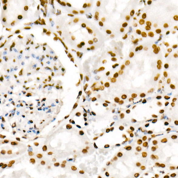 Phospho-POLR2A CTD-S2 Rabbit Monoclonal Antibody - Image 11