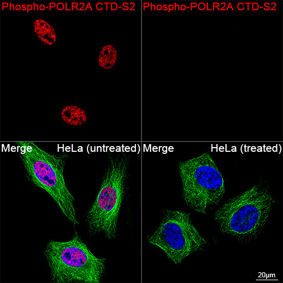 Phospho-POLR2A CTD-S2 Rabbit Monoclonal Antibody - Image 12