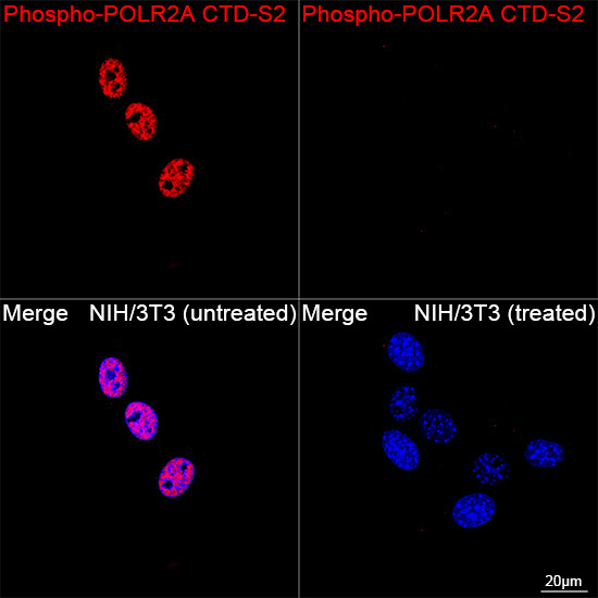 Phospho-POLR2A CTD-S2 Rabbit Monoclonal Antibody - Image 13