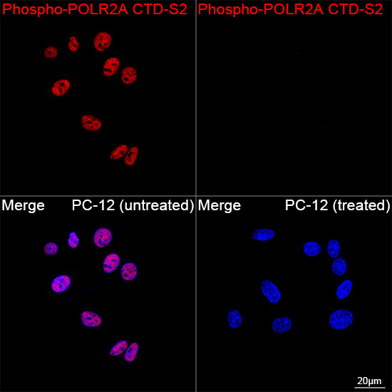 Phospho-POLR2A CTD-S2 Rabbit Monoclonal Antibody - Image 14