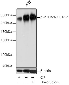 Phospho-POLR2A CTD-S2 Rabbit Polyclonal Antibody