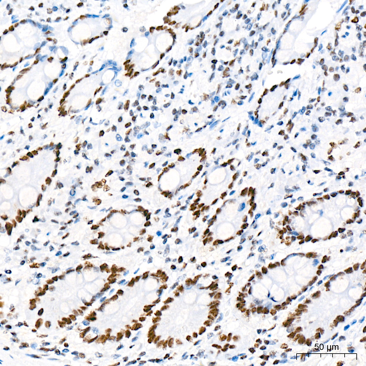 Phospho-POLR2A CTD-S5 Rabbit Monoclonal Antibody - Image 2