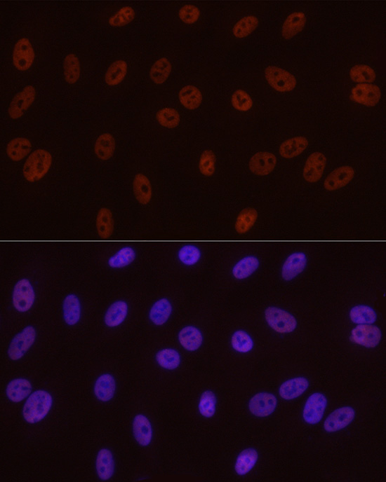 Phospho-POLR2A CTD-S5 Rabbit Monoclonal Antibody - Image 3