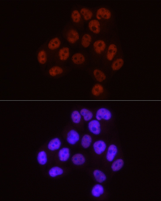 Phospho-POLR2A CTD-S5 Rabbit Monoclonal Antibody - Image 4