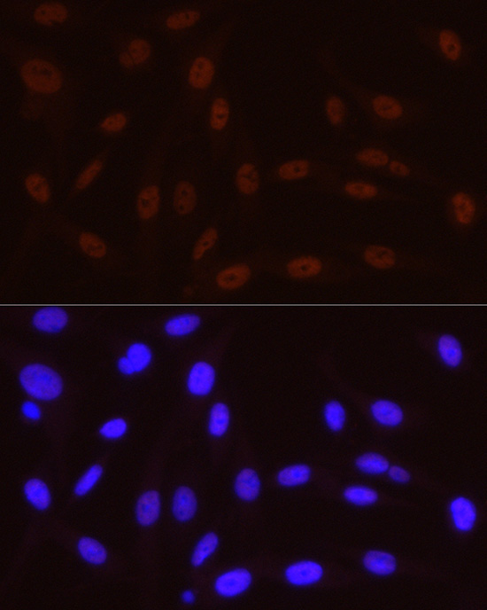 Phospho-POLR2A CTD-S5 Rabbit Monoclonal Antibody - Image 5