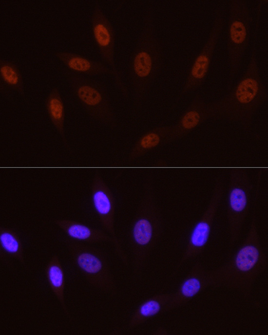 Phospho-POLR2A CTD-S5 Rabbit Monoclonal Antibody - Image 6