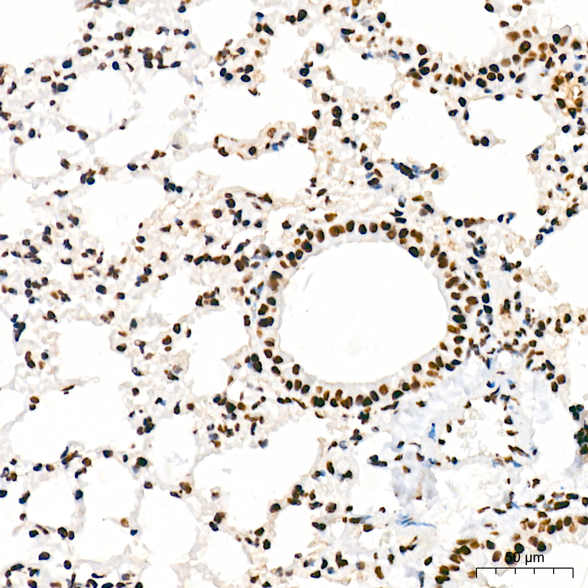 Phospho-POLR2A CTD-S5 Rabbit Monoclonal Antibody - Image 7