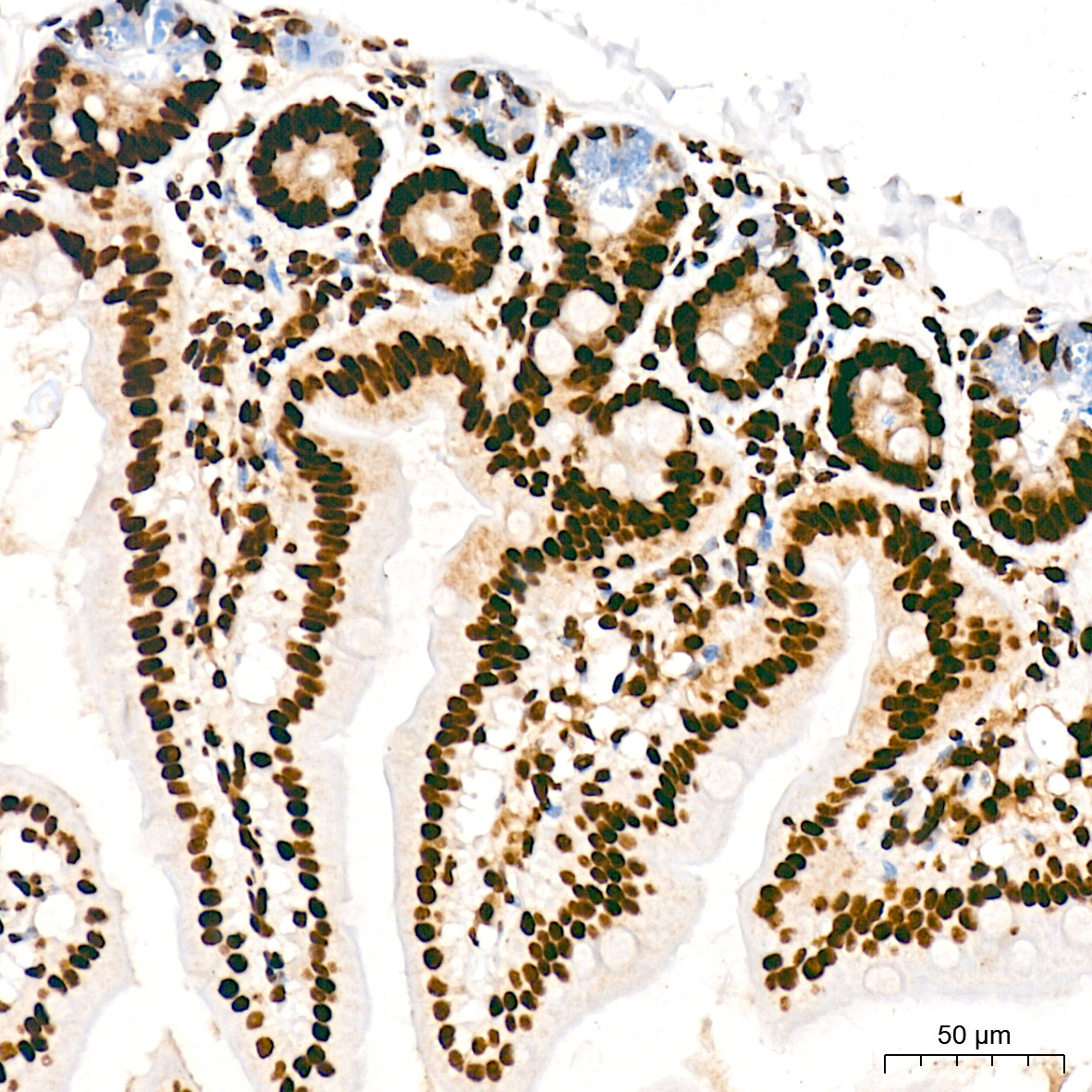 Phospho-POLR2A CTD-S5 Rabbit Monoclonal Antibody - Image 9