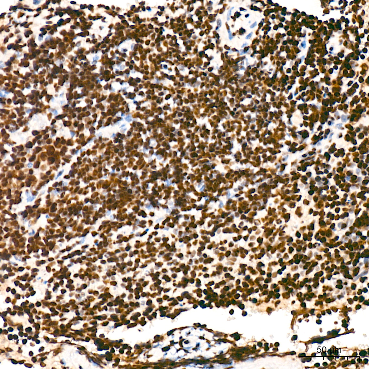 Phospho-POLR2A CTD-S5 Rabbit Monoclonal Antibody - Image 10