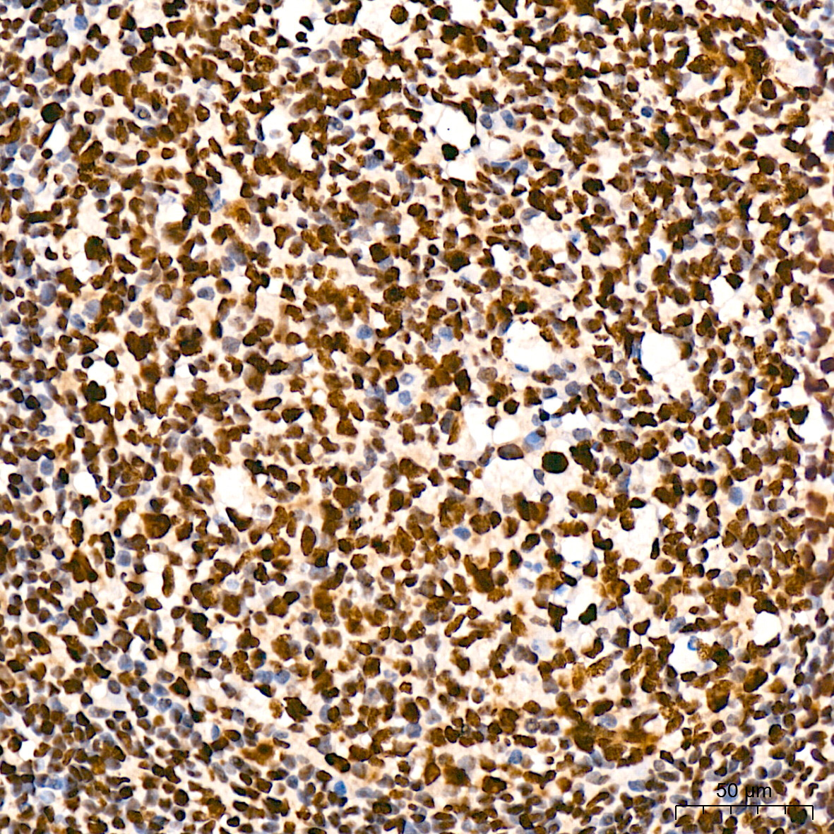 Phospho-POLR2A CTD-S5 Rabbit Monoclonal Antibody - Image 12