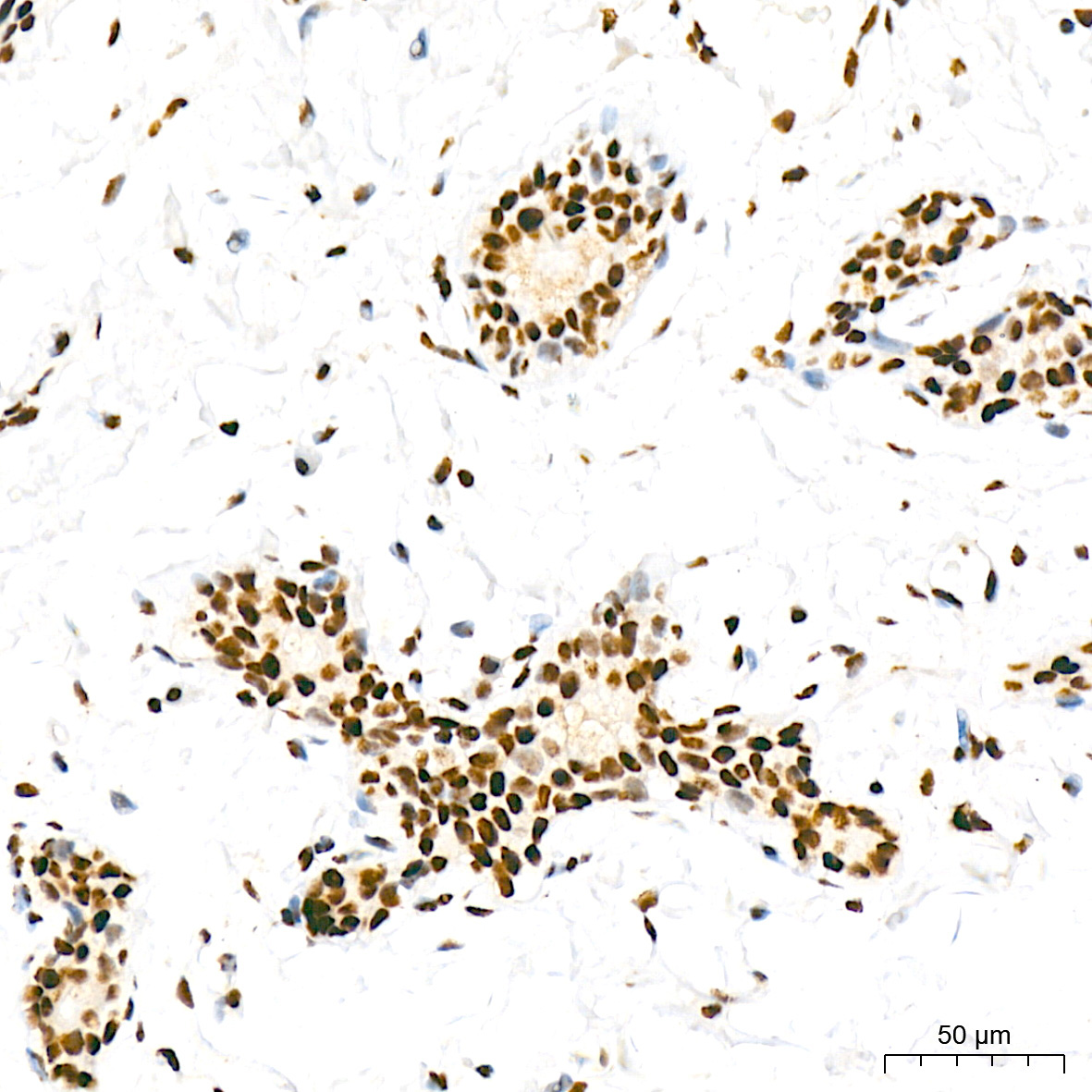 Phospho-POLR2A CTD-S5 Rabbit Monoclonal Antibody - Image 14