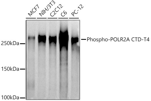 Phospho-POLR2A CTD-T4 Rabbit Polyclonal Antibody