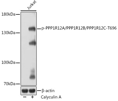 Phospho-PPP1R12A/PPP1R12B/PPP1R12C-T696 Rabbit Polyclonal Antibody