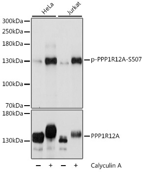 Phospho-PPP1R12A-S507 Rabbit Polyclonal Antibody