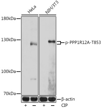 Phospho-PPP1R12A-T853 Rabbit Polyclonal Antibody