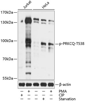 Phospho-PRKCQ-T538 Rabbit Polyclonal Antibody