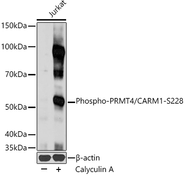 Phospho-PRMT4/CARM1-S228 Rabbit Polyclonal Antibody