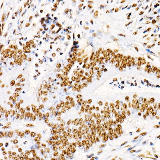 Phospho-PTEN-S380/T382/383 Rabbit Polyclonal Antibody - Image 2
