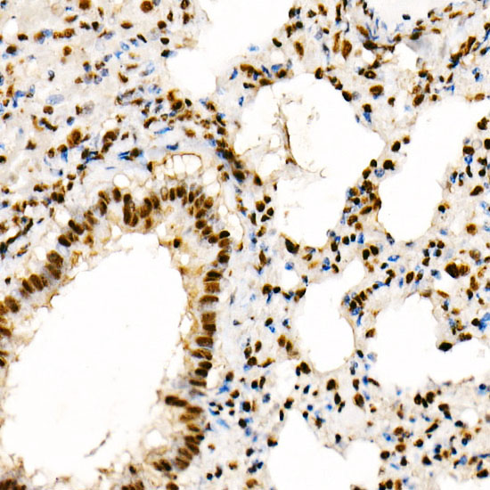 Phospho-PTEN-S380/T382/383 Rabbit Polyclonal Antibody - Image 4