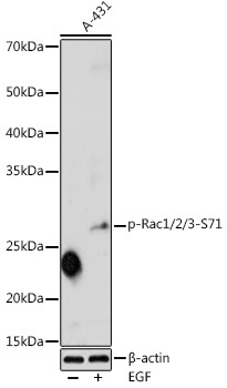 Phospho-Rac1/2/3-S71 Rabbit Polyclonal Antibody