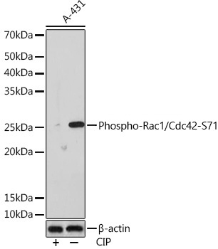 Phospho-Rac1/Cdc42-S71 Rabbit Monoclonal Antibody