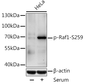 Phospho-Raf1-S259 Rabbit Polyclonal Antibody