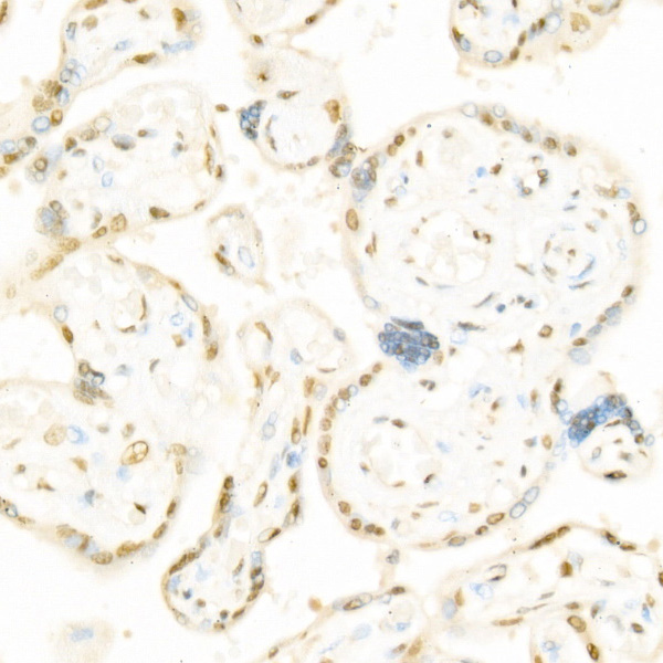 Phospho-Raf1-S338 Rabbit Polyclonal Antibody - Image 2