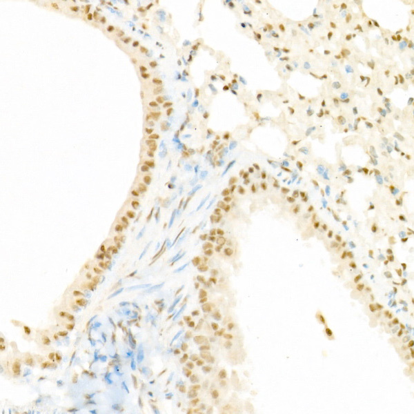 Phospho-Raf1-S338 Rabbit Polyclonal Antibody - Image 3