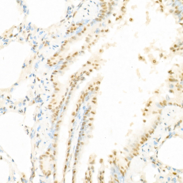 Phospho-Raf1-S338 Rabbit Polyclonal Antibody - Image 4