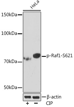 Phospho-Raf1-S621 Rabbit Monoclonal Antibody - Image 2