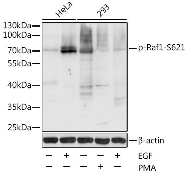 Phospho-Raf1-S621 Rabbit Polyclonal Antibody