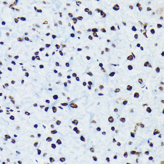 Phospho-RB-S780 Rabbit Monoclonal Antibody