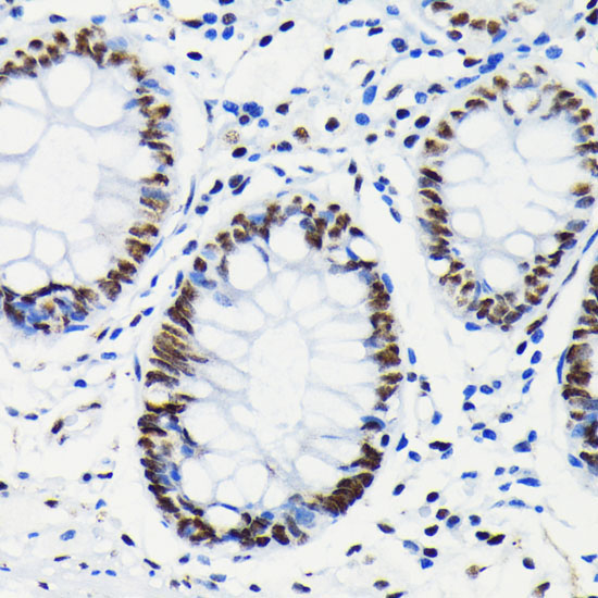 Phospho-RB-S780 Rabbit Monoclonal Antibody - Image 2