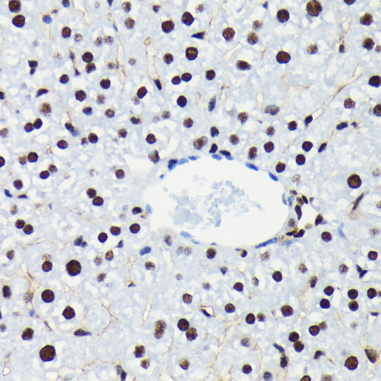Phospho-RB-S780 Rabbit Monoclonal Antibody - Image 3
