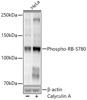 Phospho-RB-S780 Rabbit Monoclonal Antibody
