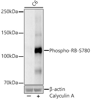 Phospho-RB-S780 Rabbit Monoclonal Antibody - Image 2