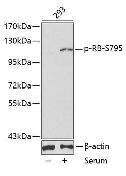 Phospho-RB-S795 Rabbit Polyclonal Antibody