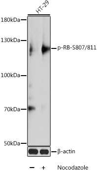 Phospho-RB-S807/811 Rabbit Polyclonal Antibody