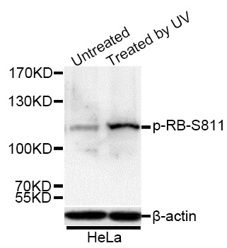 Phospho-RB-S811 Rabbit Polyclonal Antibody